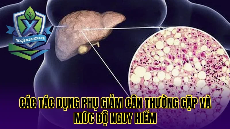 Các tác dụng phụ giảm cân thường gặp và mức độ nguy hiểm